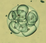 Egg